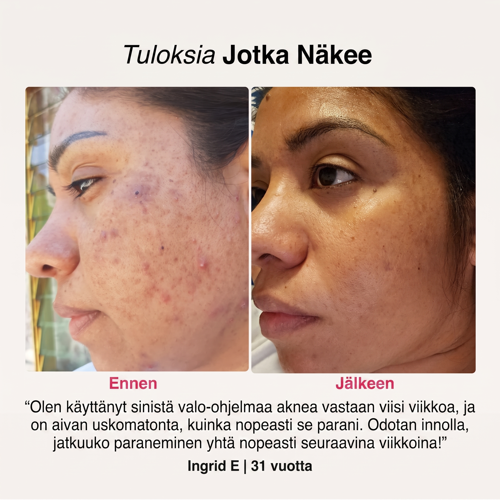 SoftSkin InfraLight® | Kasvot, Kaula & Rinta