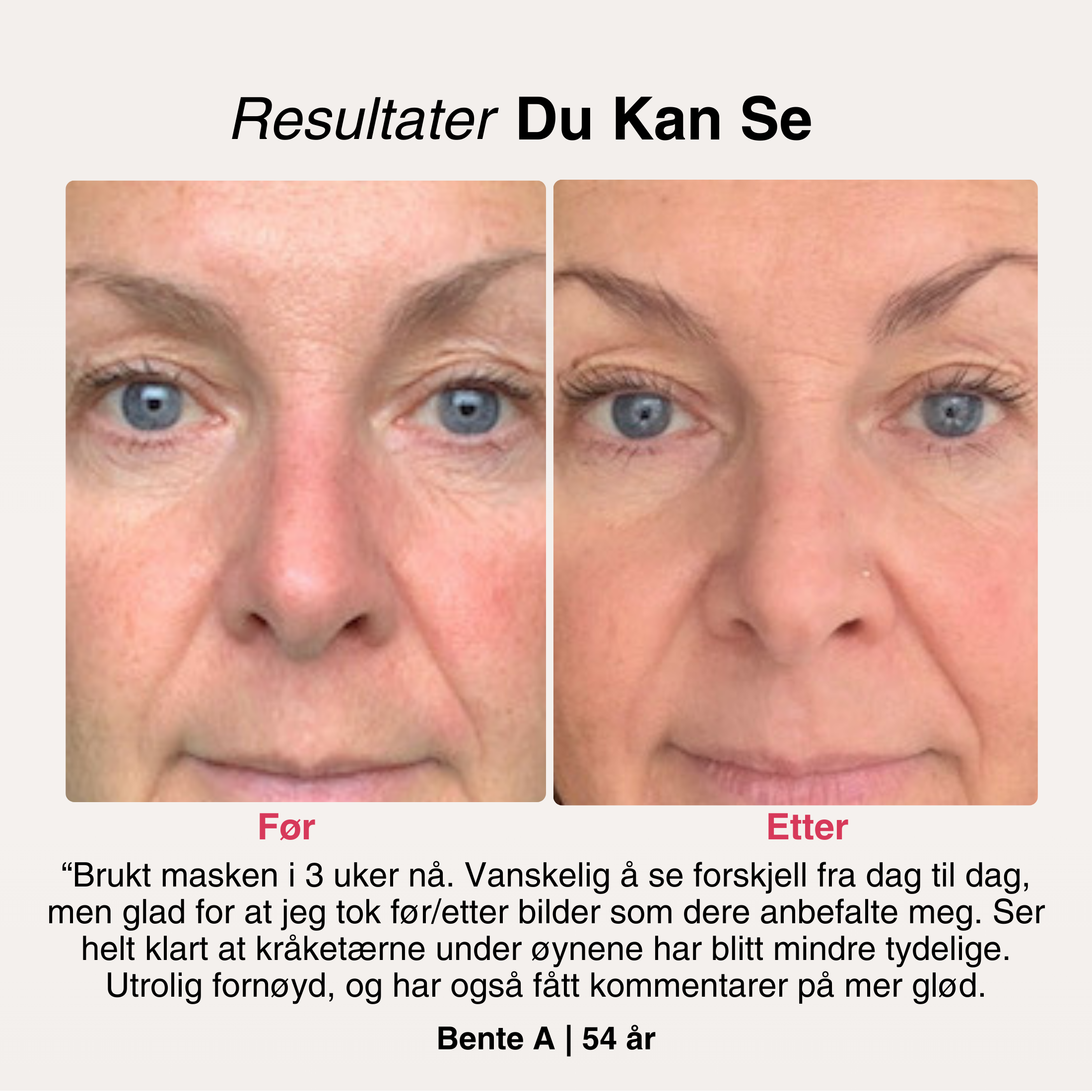 AntiAge-Naamio® – 7