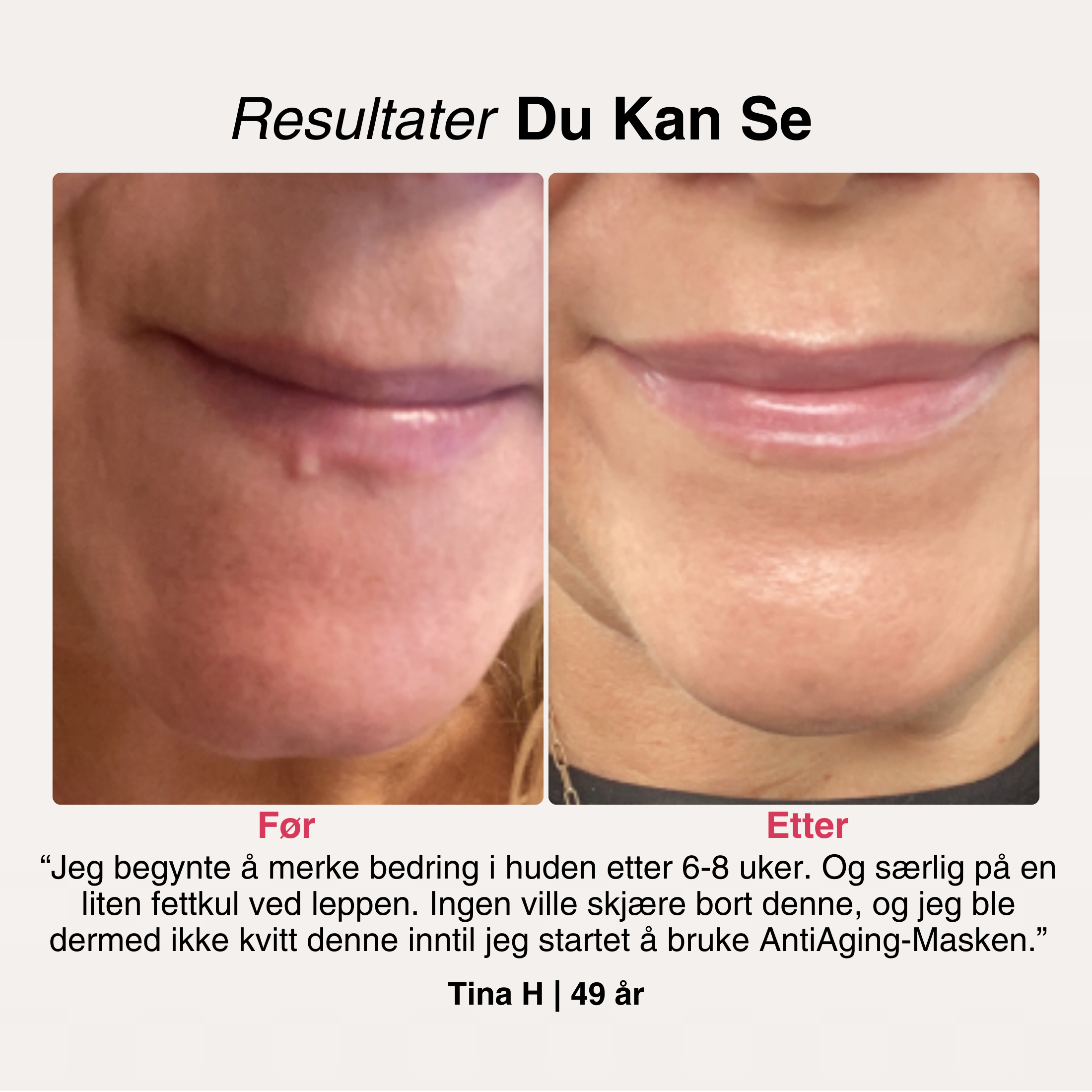 AntiAge-Naamio® – 6