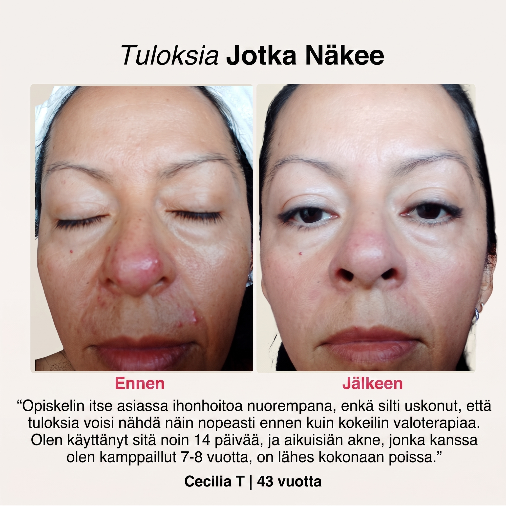 SoftSkin InfraLight | Kasvot, Kaula & Rinta